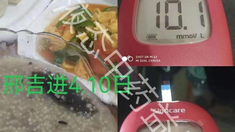 胶原蛋白肽20岁开始吃会不会太早